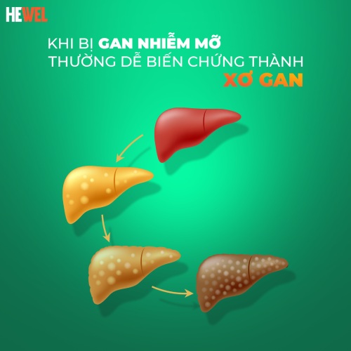 gan nhiễm mỡ biến chứng tổn thương gan