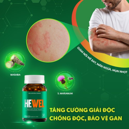 hewel chữa viêm da cơ địa
