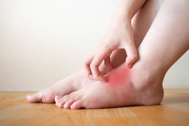 ngứa biếu hiện bệnh gan