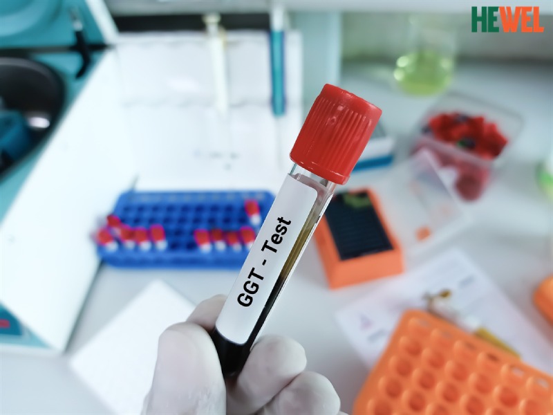 các chỉ số men gan
