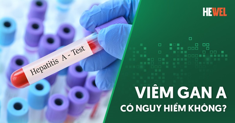 Viêm gan A có nguy hiểm không? Thời gian ủ bệnh và biến chứng