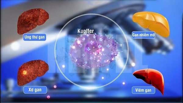 tế bào kupffer gan