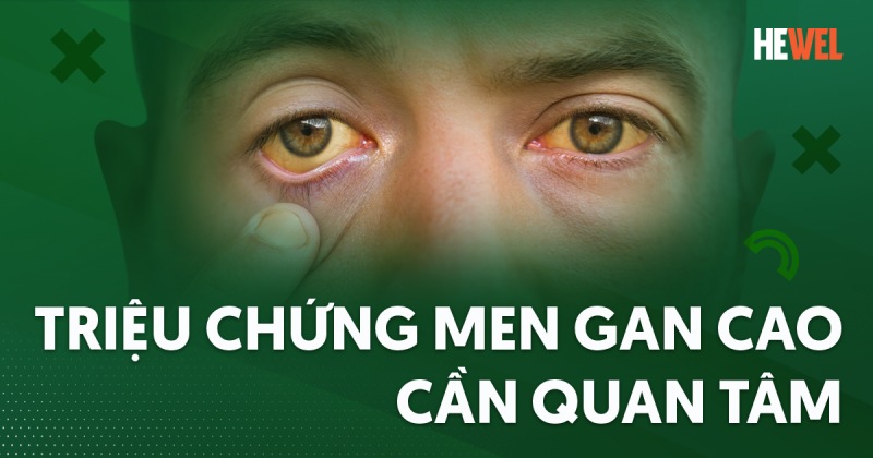 triệu chứng men gan cao