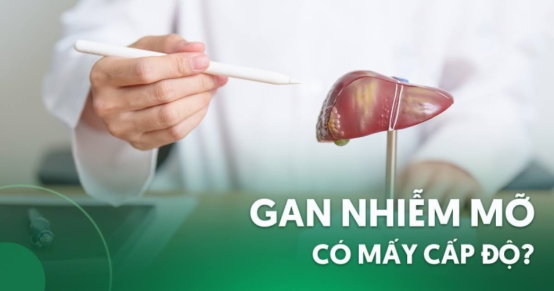 3 cấp độ gan nhiễm mỡ: Dấu hiệu và mức độ nguy hiểm?