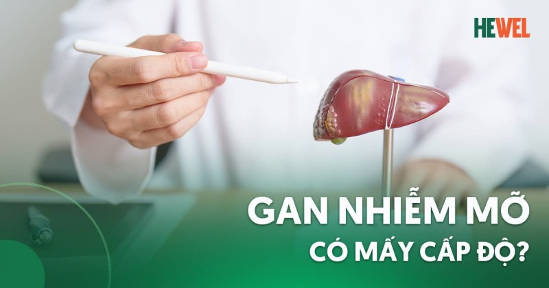 3 cấp độ gan nhiễm mỡ: Dấu hiệu và mức độ nguy hiểm?