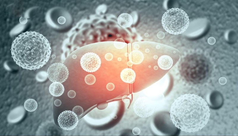 gan nhiễm mỡ độ 3 nguy hiểm không