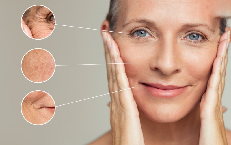 da sần sùi dễ lão hóa