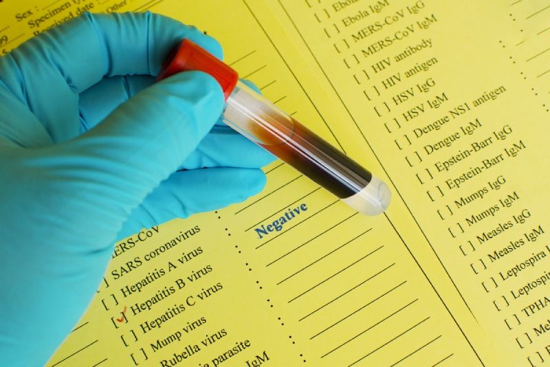 Xét nghiệm viêm gan B âm tính là gì? Có khả năng lây bệnh không?