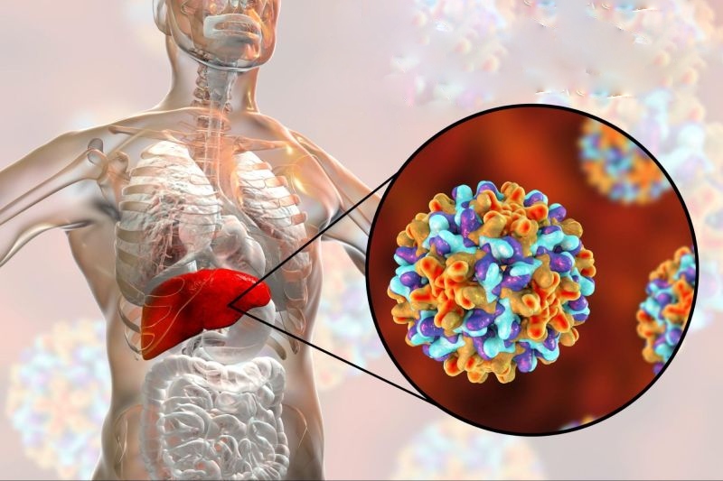 người bị viêm gan b