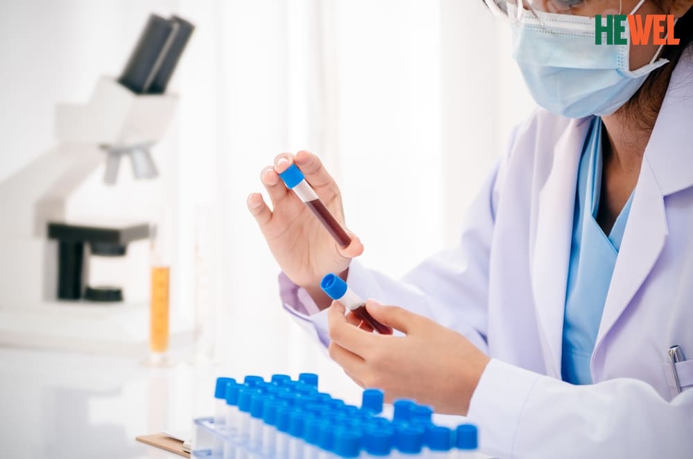 6 Việc quan trọng cần nhớ khi chăm sóc bệnh nhân viêm gan siêu vi B