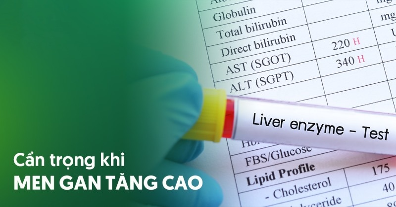 Men gan cao là bệnh gì? Chẩn đoán và cách phòng ngừa