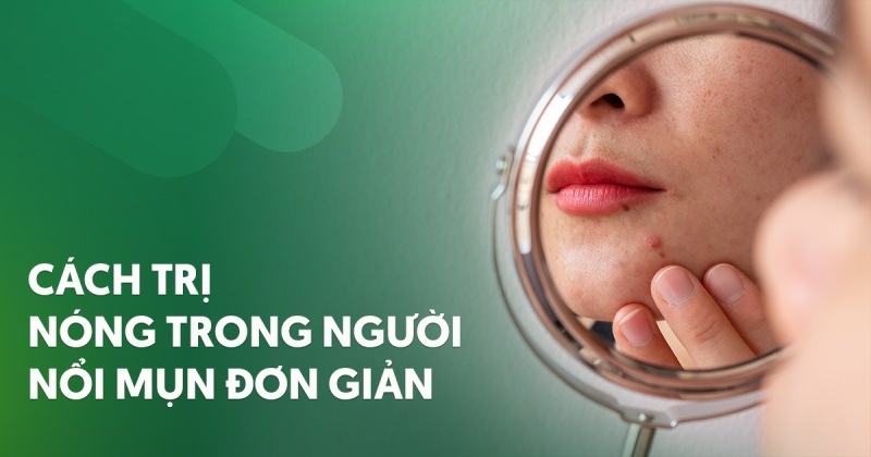 Nóng trong người nổi mụn: 10 nguyên nhân và cách điều trị
