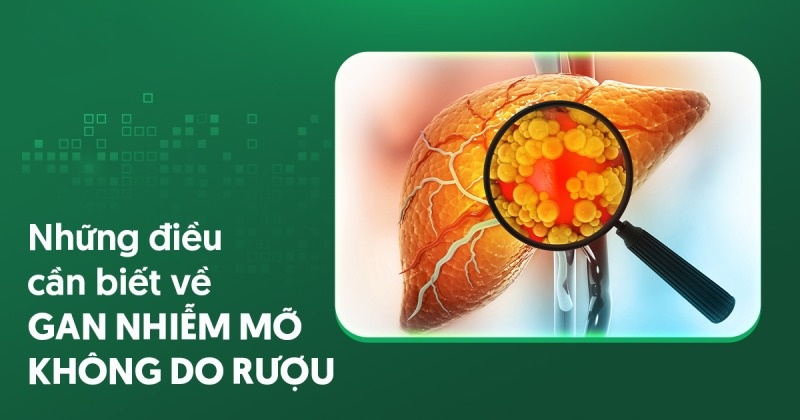 gan nhiễm mỡ không do rượu