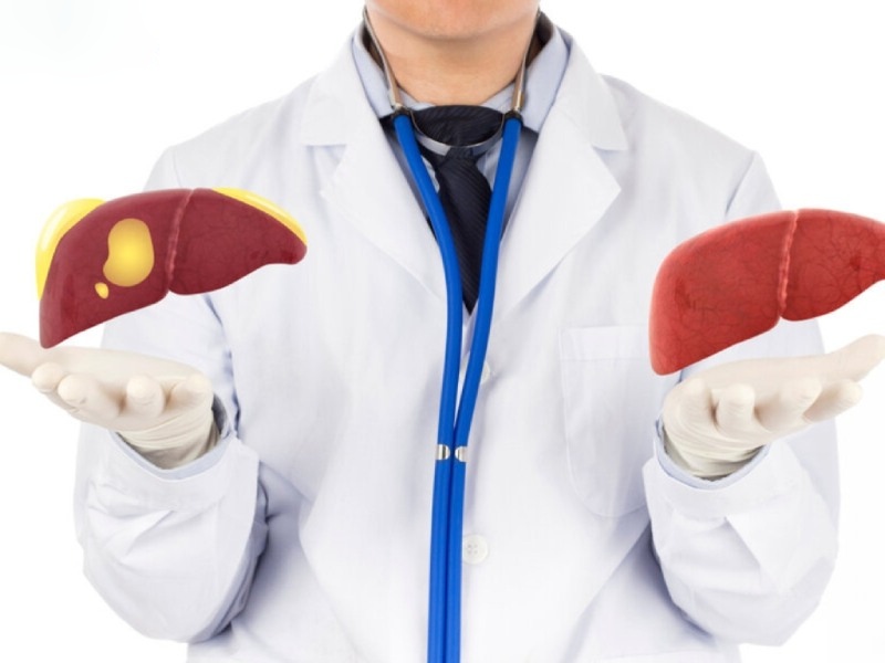 các biến chứng gan nhiễm mỡ