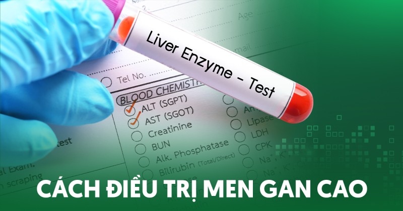 Top 2 cách điều trị men gan cao nhanh chóng và an toàn