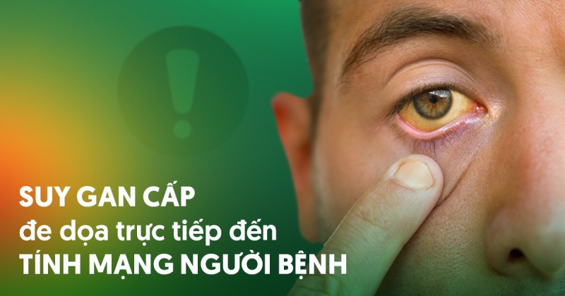 Suy gan cấp: Nguyên nhân, triệu chứng và cách điều trị, phòng ngừa