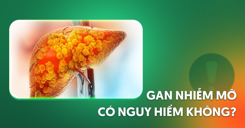 Gan nhiễm mỡ có nguy hiểm không? 5 biến chứng dễ gây nguy cơ
