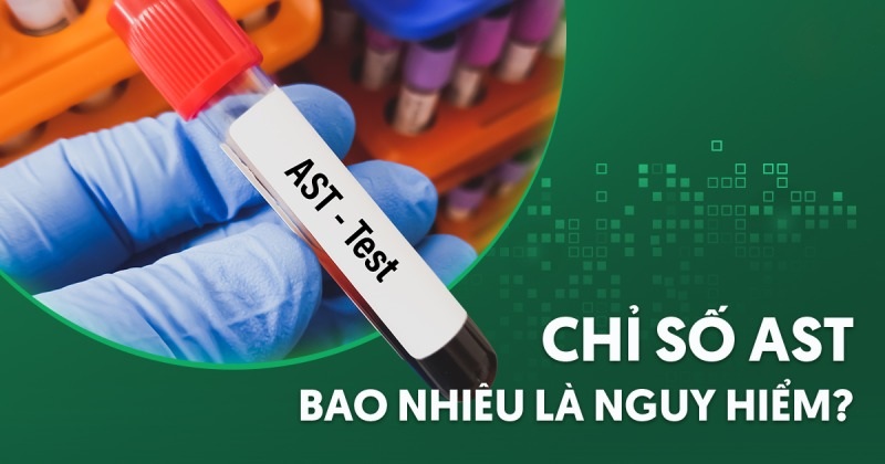 chỉ số ast là gì