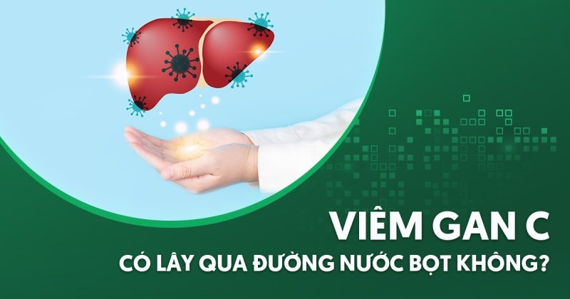 viêm gan c có lây qua đường nước bọt không