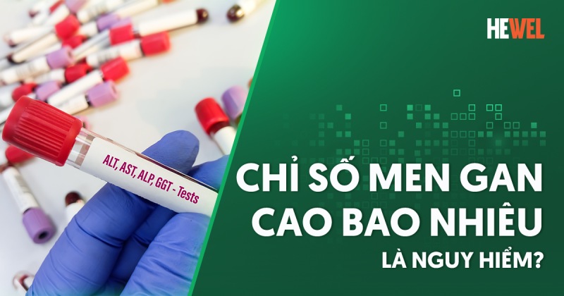 chỉ số men gan cao