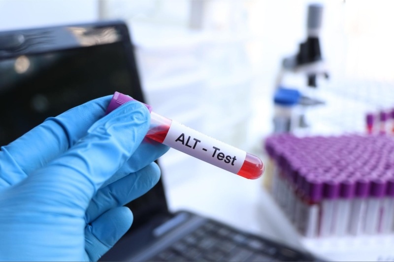 xét nghiệm chỉ số alt