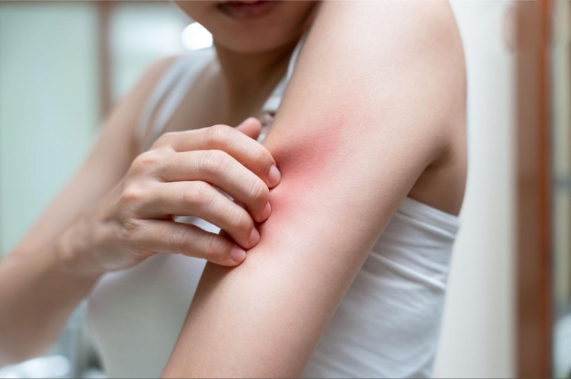 men gan cao có gây ngứa không