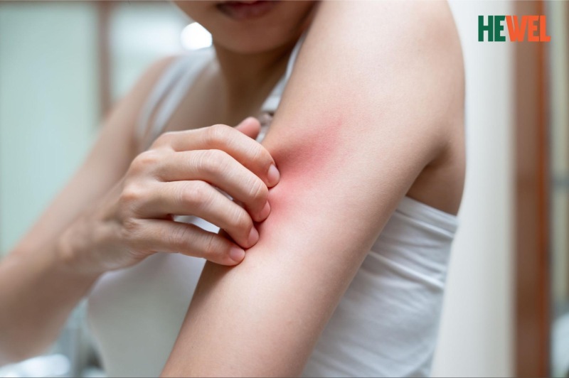 men gan cao có gây ngứa không