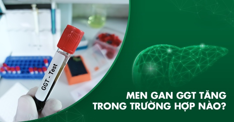 Men gan GGT tăng trong trường hợp nào? Có cần lưu ý gì không?