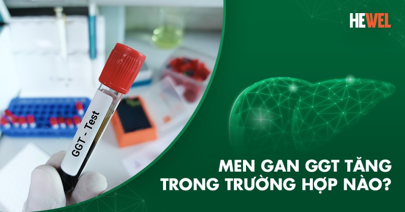 Men gan GGT tăng trong trường hợp nào? Có cần lưu ý gì không?