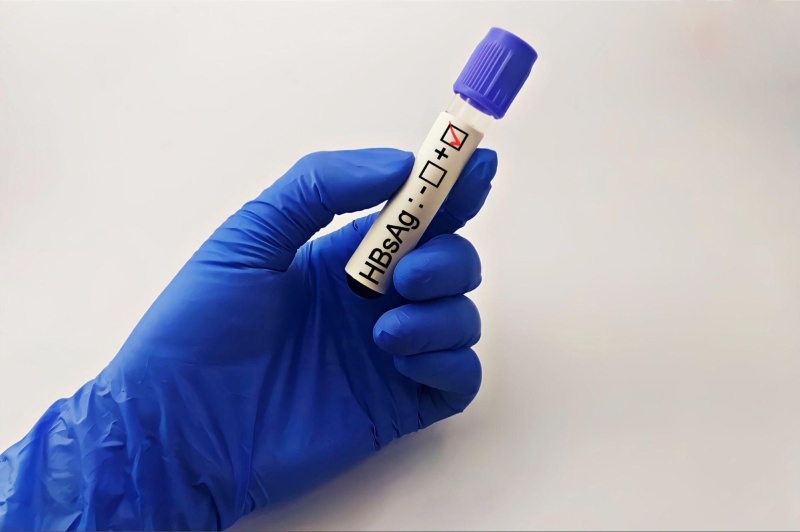 xét nghiệm hbsag