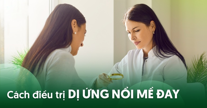 5 cách điều trị dị ứng nổi mề đay hiệu quả, an toàn