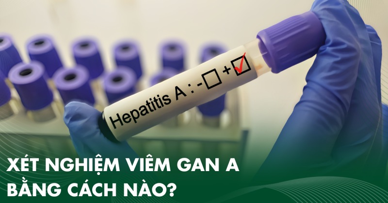 Xét nghiệm viêm gan A bằng cách nào? Cách đọc kết quả chỉ số