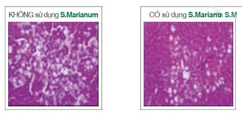 s.marianum giúp giảm tổn thương gan