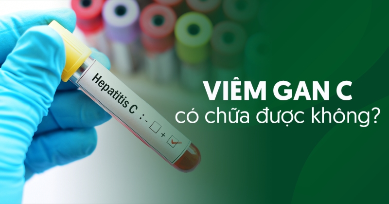 Viêm gan C có chữa được không? Bao lâu thì hết virus?