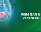 Viêm gan ứ sắt: Căn bệnh âm thầm hủy hoại gan