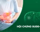 Hội chứng Budd-Chiari là gì? Cơ chế sinh bệnh