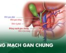 Giải phẫu động mạch gan chung: Ý nghĩa lâm sàng