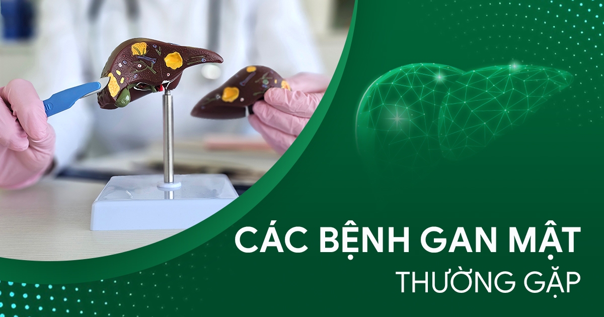 bệnh gan mật